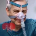 RespBuy-Lowenstein-cara-nasal-mask.jpg